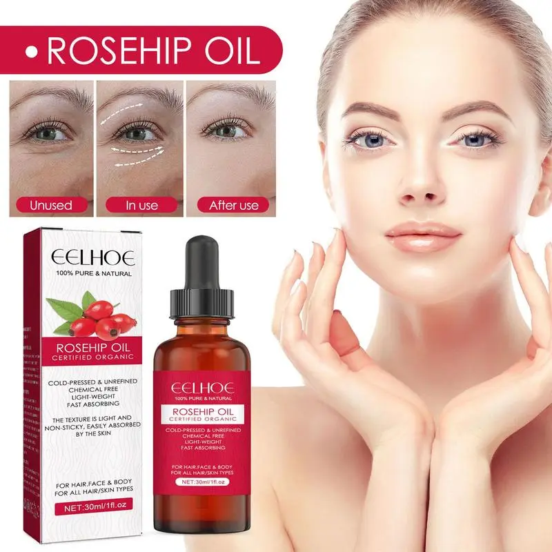 Cold Pressed Rose Hip - Huile de graines de rose musquée