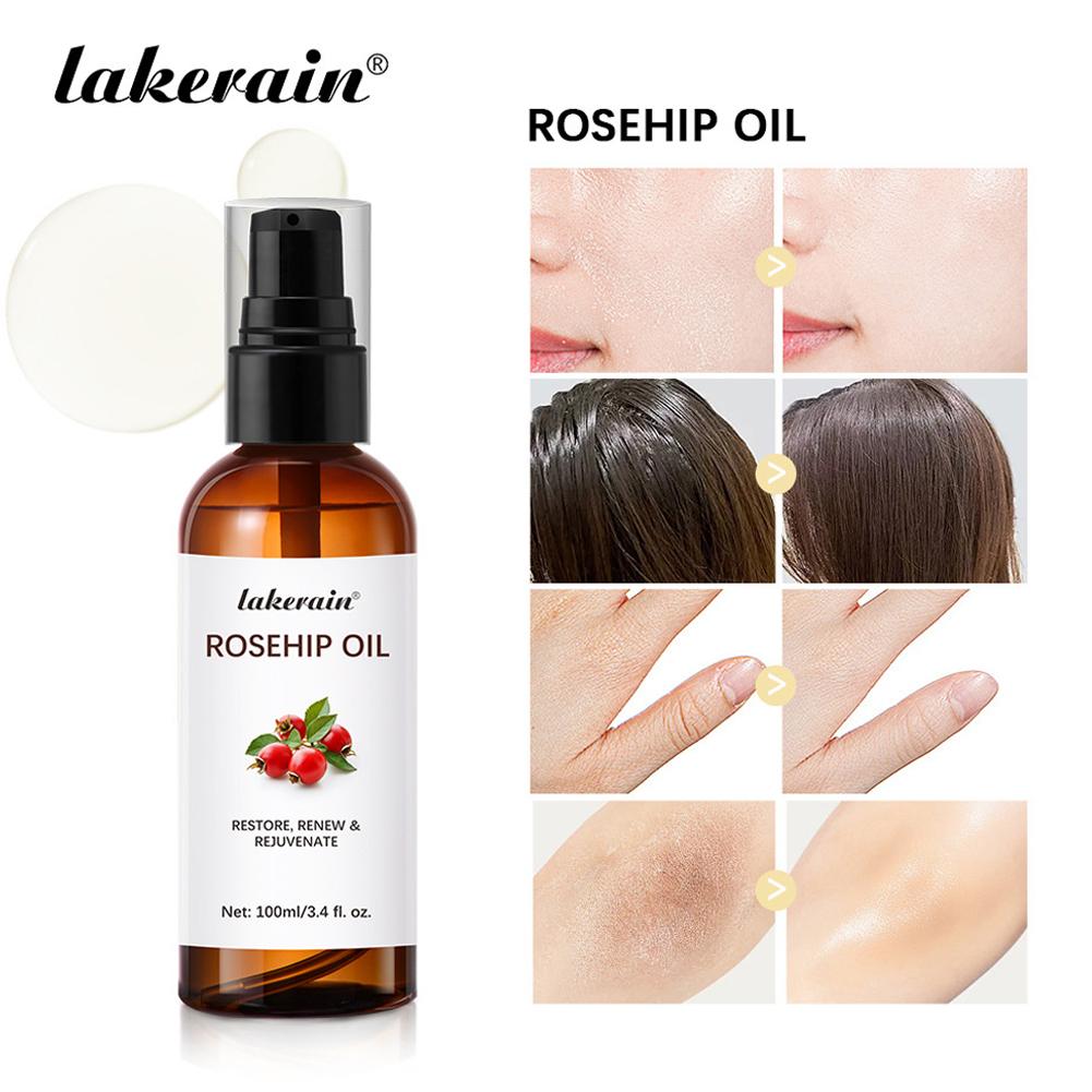 Huile de rose musquée pour le  - Cold Pressed Rose Hip avis et prix